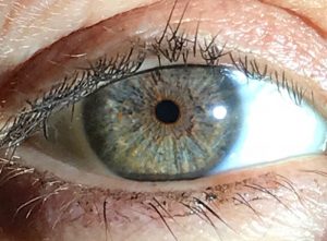 IrexLaser permanent eye Color change technology